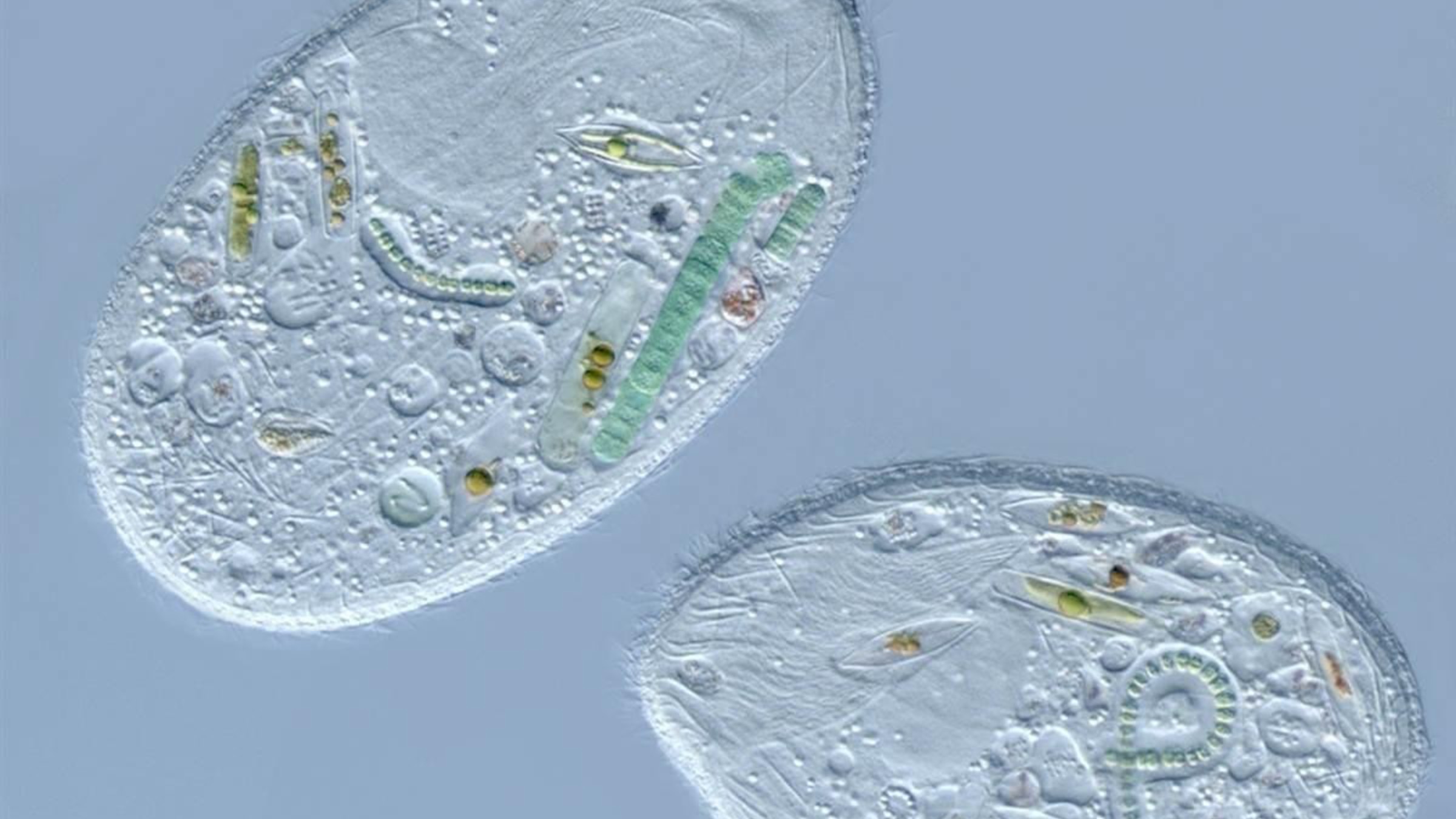 Большинство бактерий можно увидеть. Микрофотография бактериальной клетки. Микрофотография клетки эукариот. Клетка бактерии в микроскопе. Клетка бактерии микрофото.