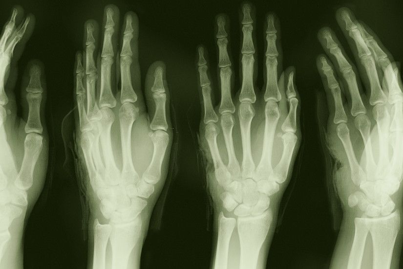 Dark - Skeleton Medical Green Hand X-Ray Wallpaper