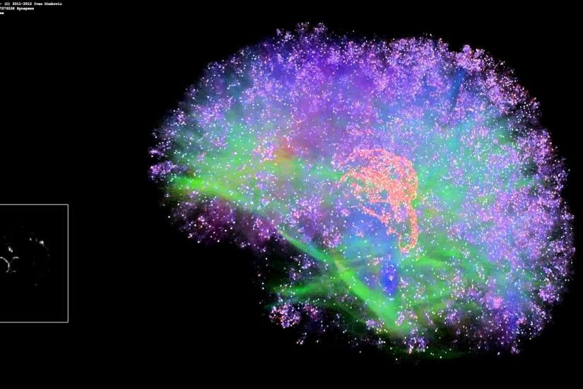 Can Supercomputers Now Mimic the Human Brain? Neuron Wallpaper Brain  Artificial Brain Simulation - Thalamocortical ...