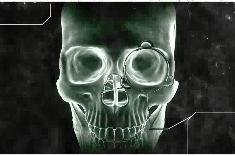 Human Skull X Ray